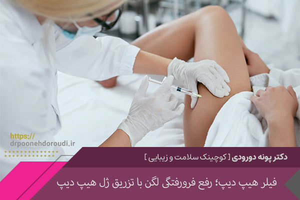 فیلر هیپ دیپ