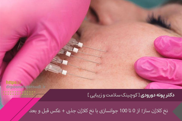 نخ کلاژن ساز