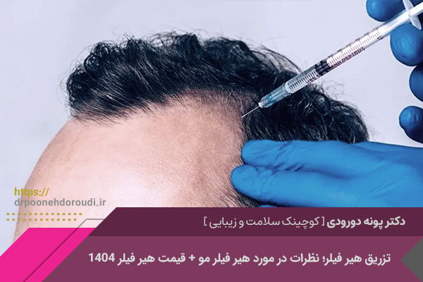 هیر فیلر چیست