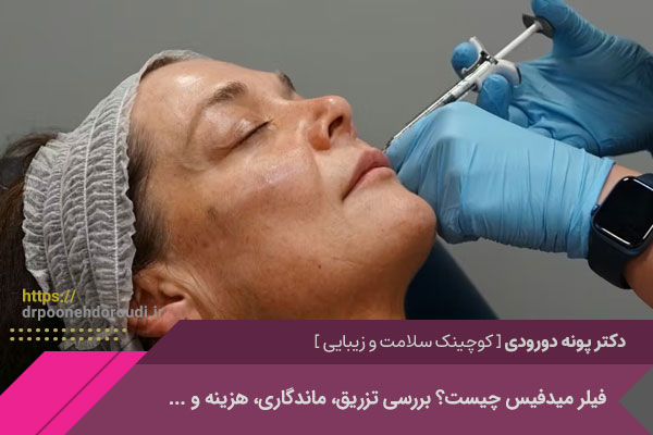 فیلر میدفیس 