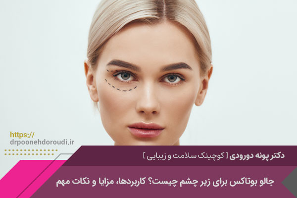 جالو بوتاکس برای زیر چشم