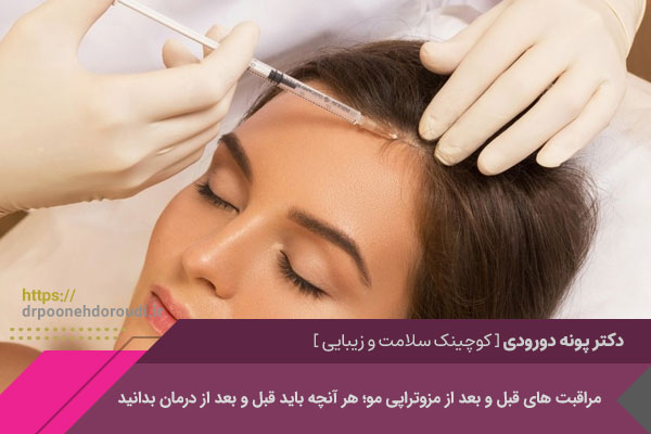 چرا رعایت مراقبت های قبل و بعد از مزوتراپی مو اهمیت دارد؟