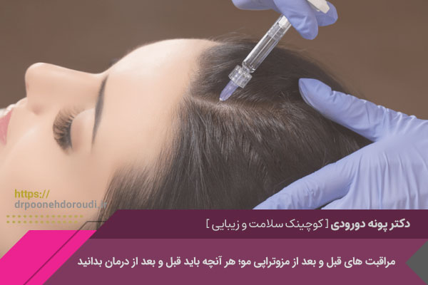 چه علائمی بعد از مزوتراپی مو نیاز به مراجعه به پزشک دارند؟