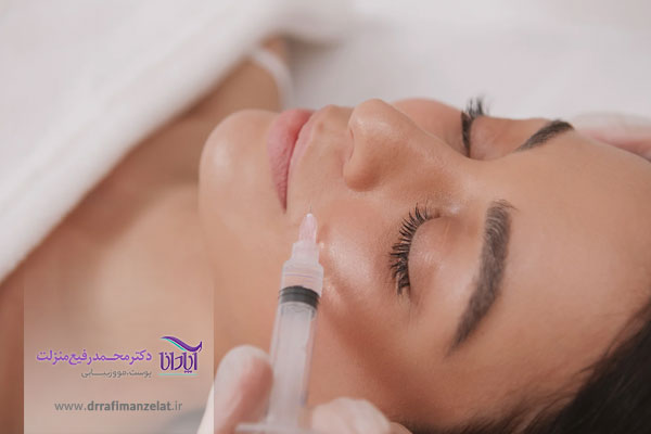 عکس تزریق ژل خط خنده 