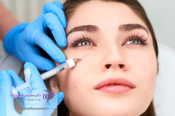 رفع تیرگی و گودی زیر چشم با تزریق بوتاکس 