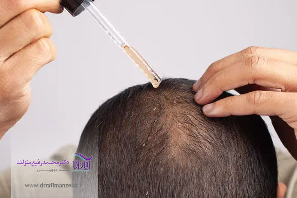 ریزش مو بر اثر مصرف دارو