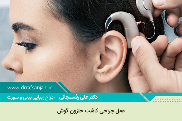 عمل جراحی کاشت حلزون گوش در کرج