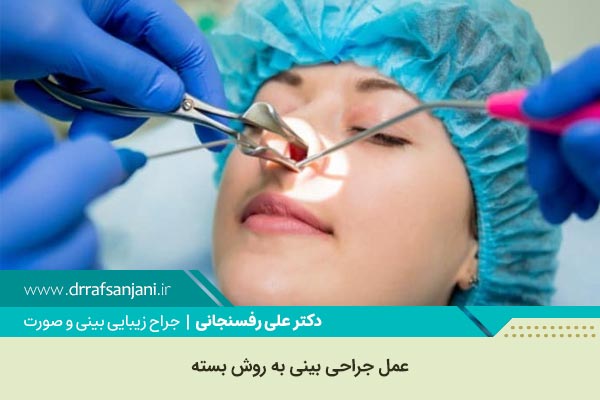 جراحی بینی بسته در شهریار و کرج