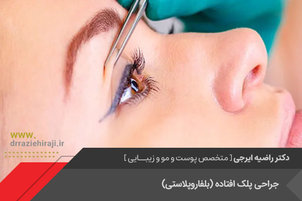 جراحی پلک افتاده در اصفهان