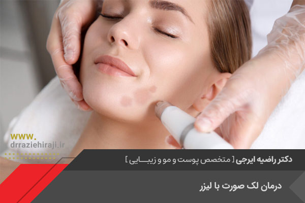 لیزر رفع لک صورت در اصفهان