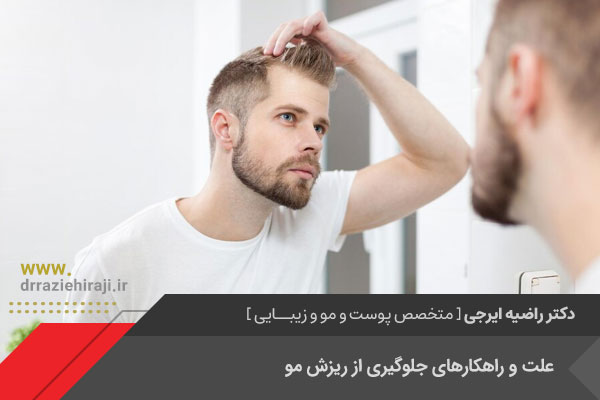 جلوگیری از ریزش مو