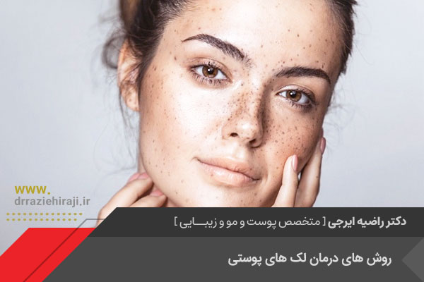 درمان لک های پوستی در اصفهان