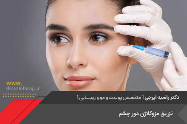جوانسازی دور چشم با تزریق مزوکلاژن در اصفهان