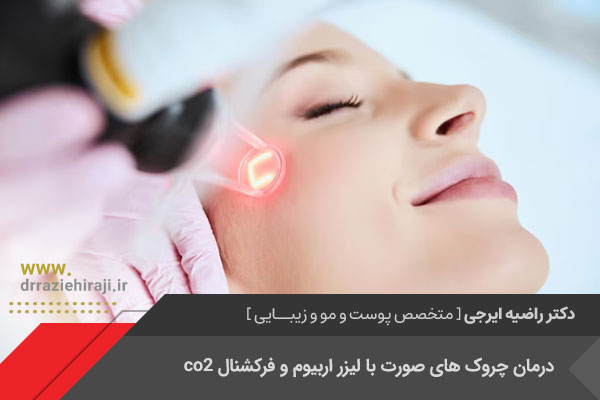 درمان چروک پوست با لیزر فرکشنال و اربیوم در اصفهان