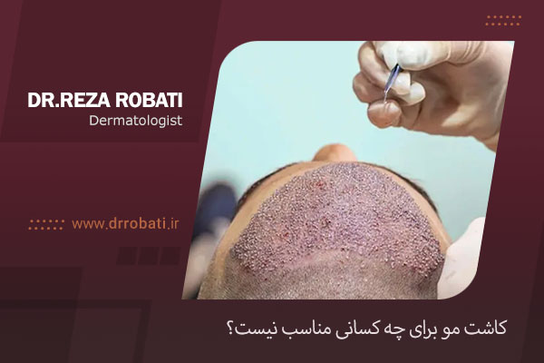 ممنوعیت کاشت مو
