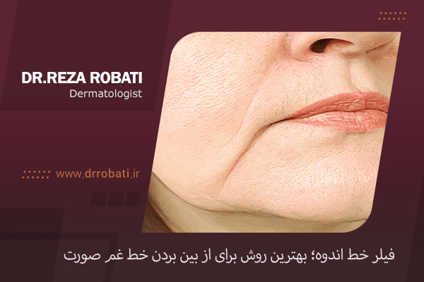 فیلر خط اندوه