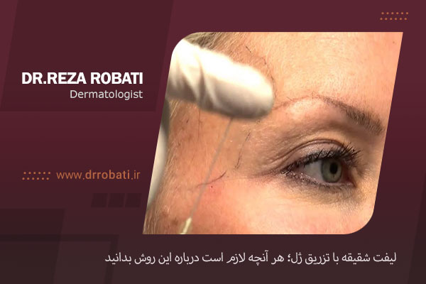 ژل شقیقه