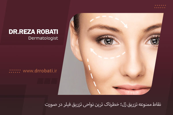 نقاط ممنوعه تزریق ژل