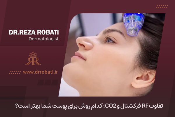 تفاوت rf و co2