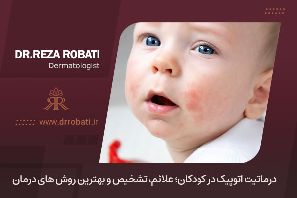 درماتیت آتوپیک در کودکان 