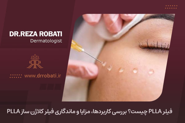 کاندیدای مناسب پی ال ال آ چه ویژگی های دارد
