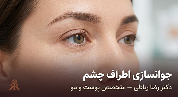 جوانسازی دور چشم 