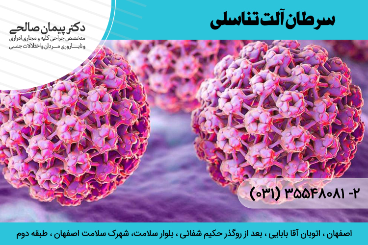 درمان سرطان آلت تناسلی در اصفهان