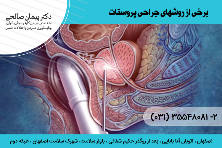 بهترین جراح پروستات در اصفهان