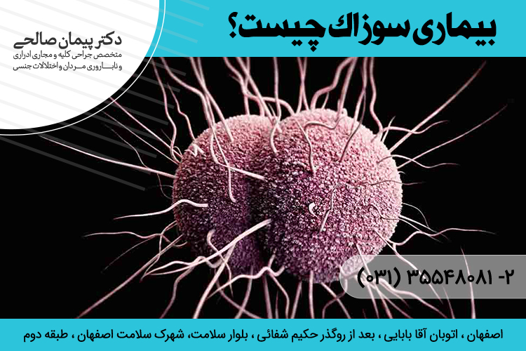 درمان بیماری سوزاک در اصفهان