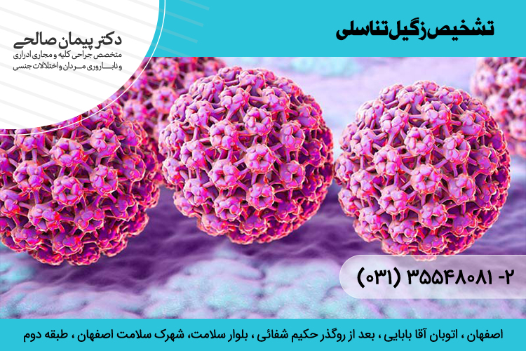 بهترین درمان و تشخیص زگیل تناسلی در اصفهان