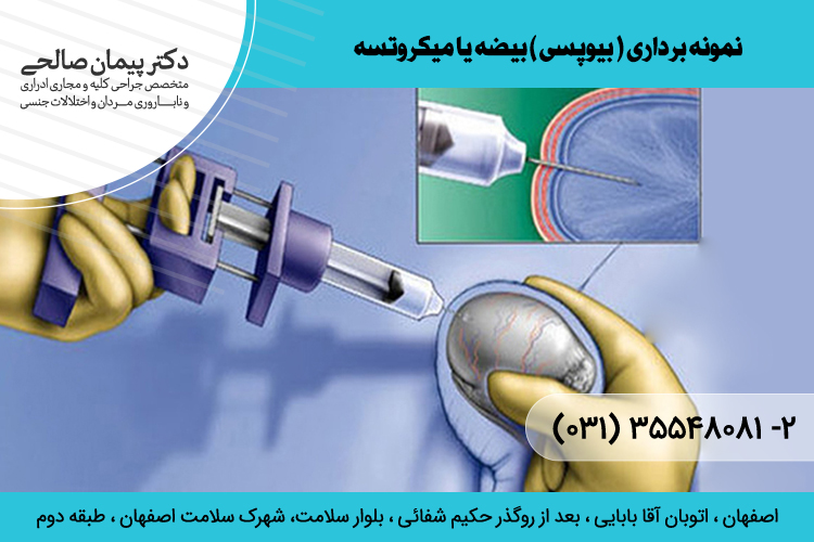 بهترین نمونه برداری از بیضه در اصفهان