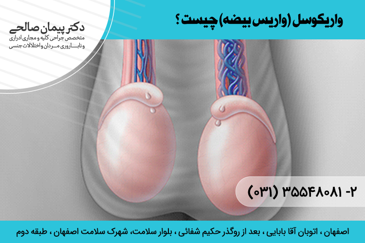 واریکوسل چیست و درمان آن چگونه است؟