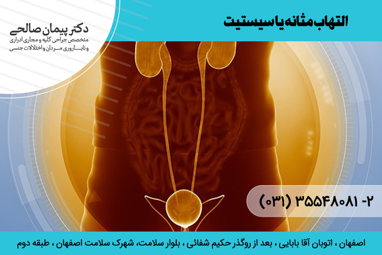 التهاب مثانه یا سیستیت و درمان آن در اصفهان
