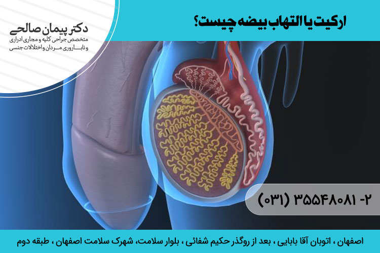 درمان التهاب بیضه در اصفهان