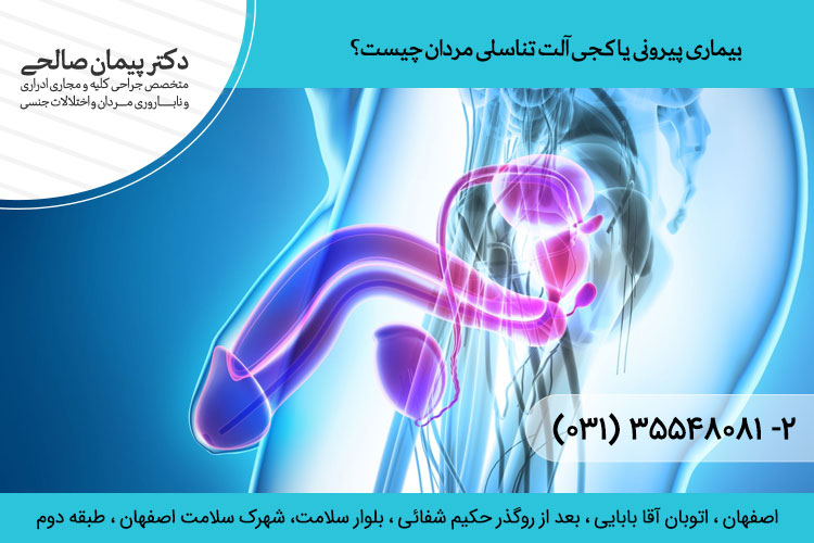 درمان بیماری پیرونی یا کجی آلت تناسلی