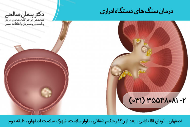 آشنايي با سنگهاي ادراري و روش هاي پيشگيري و درمان آنها