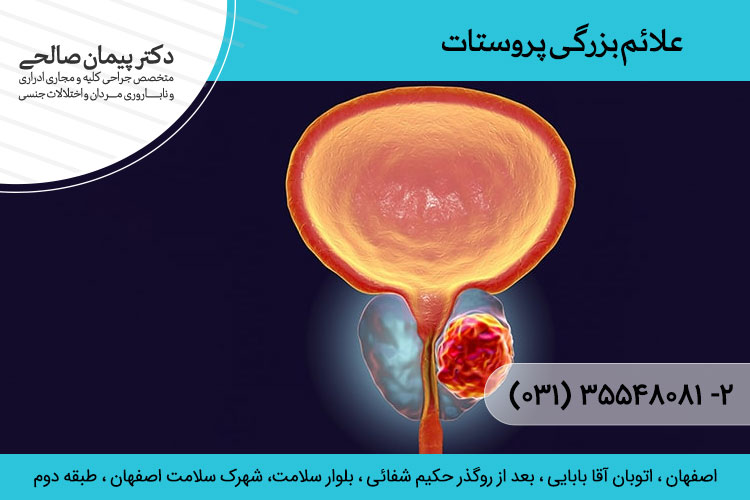 التهاب پروستات | بزرگی خوش خیم پروستات