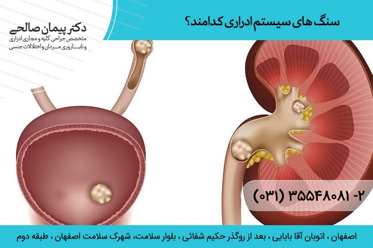 سنگ های سیستم ادراری کدامند؟