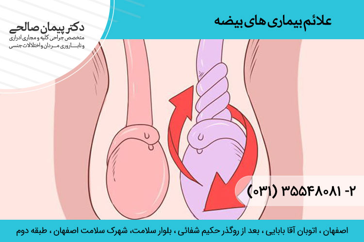 بیماری های بیضه را بشناسید