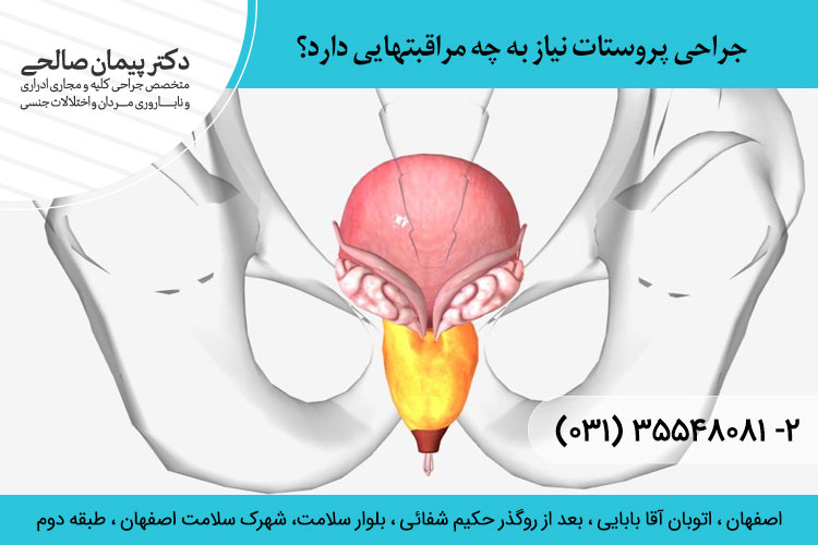 جراح پروستات در اصفهان