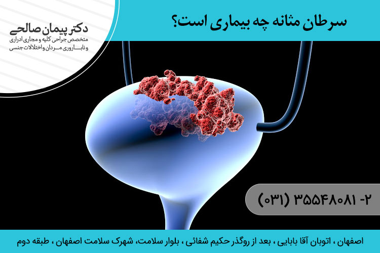 سرطان مثانه چه بیماری است؟