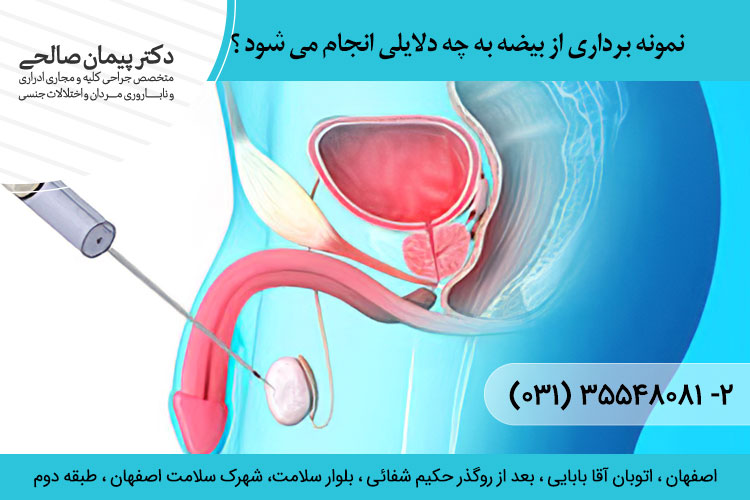 نمونه برداری از بیضه به چه دلایلی انجام می شود ؟