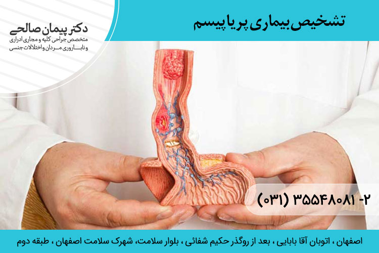 پریاپیسم چیست و چگونه درمان میشود؟