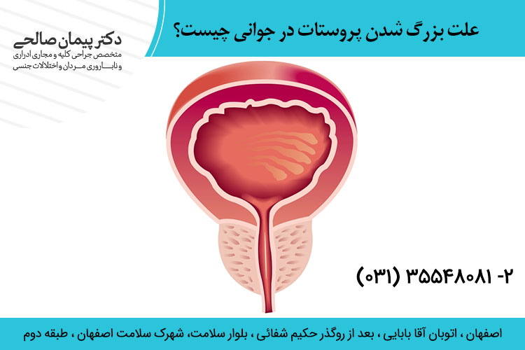 علت بزرگ شدن پروستات