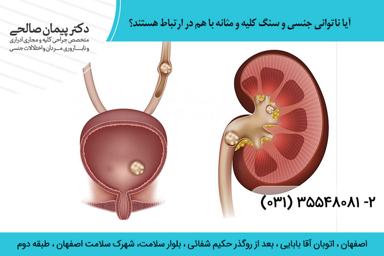 ناتوانی جنسی و سنگ های سیستم ادراری