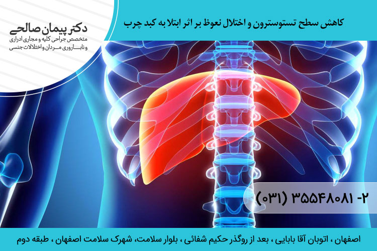 کبد چرب و اختلال نعوظ