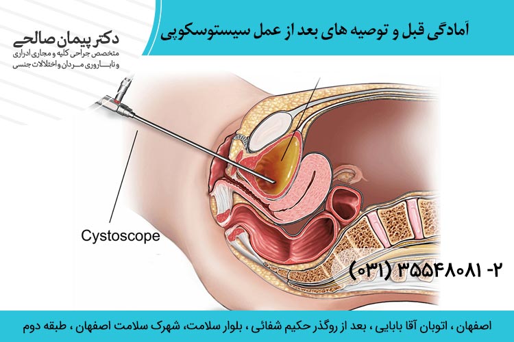 عمل سیستوسکوپی