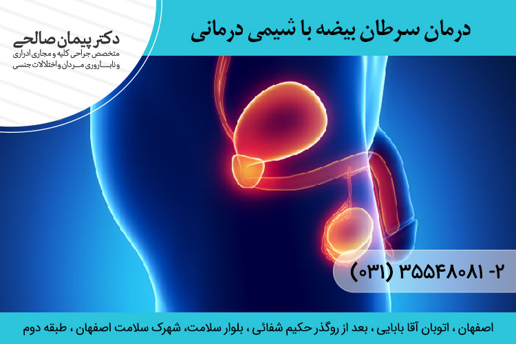 درمان سرطان بیضه با شیمی درمانی