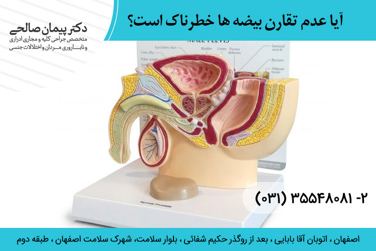 عدم تقارن بیضه