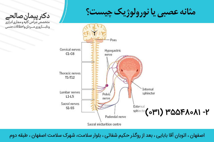 مثانه عصبی یا نورولوژیک